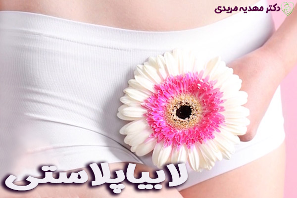 لابیاپلاستی