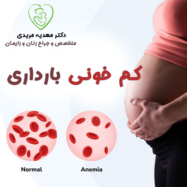 کم خونی بارداری - دکتر مهدیه مریدی