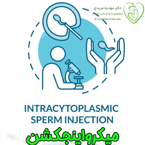 میکرواینجکشن icsi