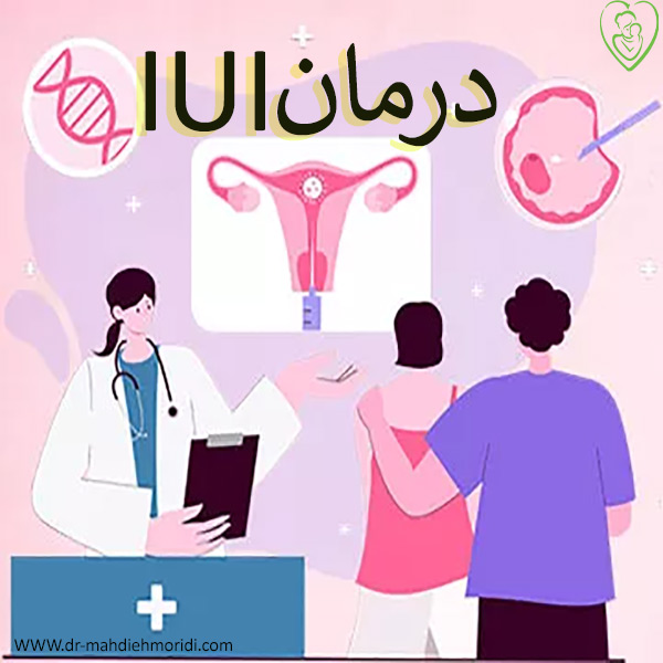 درمان IUI در لرستان - دکتر مهدیه مریدی
