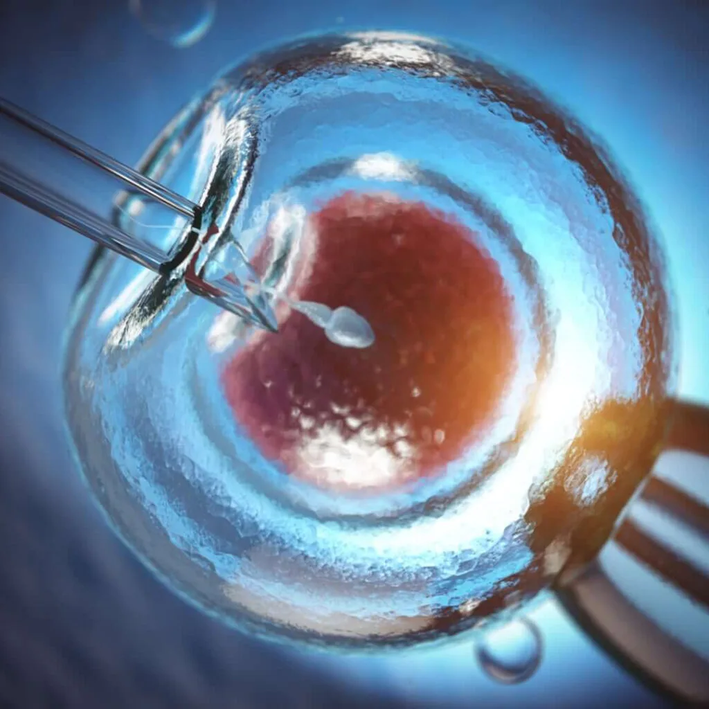 ivf
