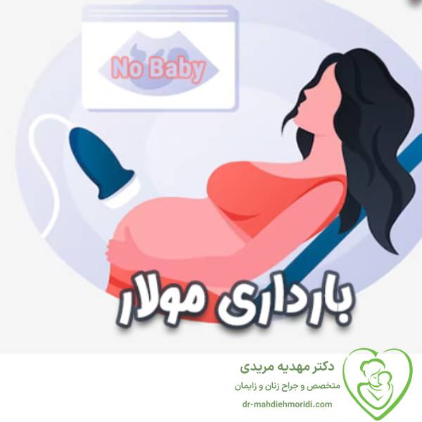 بارداری مولار