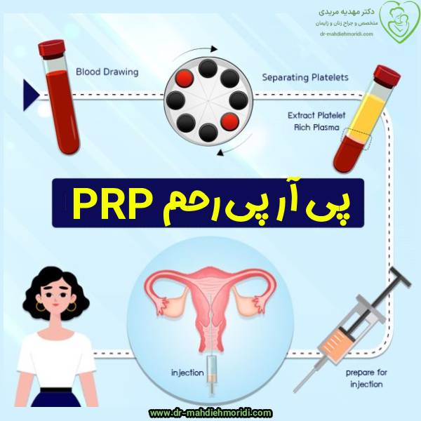 پی آر پی رحم - دکتر مهدیه مریدی