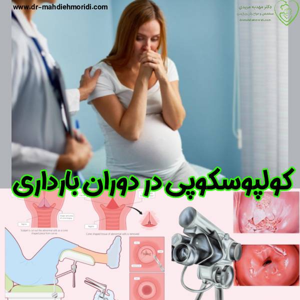 کولپوسکوپی در بارداری - دکتر مهدیه مریدی
